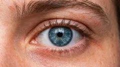 Hoe kan je een hangend ooglid liften? 3 belangrijkste oorzaken en correctiemethoden